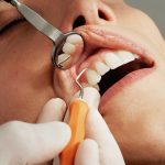 How Often Should Your Family Visit the Dentist?