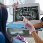 Can Dental Implants Improve My Oral Health?