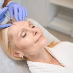 Why Do Vets Recommend Acupuncture for Trauma in Pets?